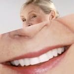 Dental Marketing Case Study: Perfect Smiles For Less | Agency Creative